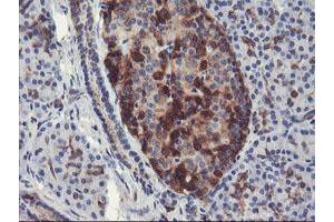 Immunohistochemical staining of paraffin-embedded Human pancreas tissue using anti-PFKP mouse monoclonal antibody.