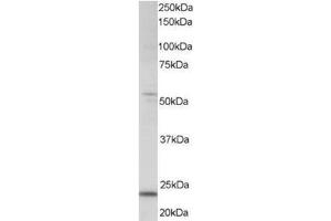 Image no. 1 for anti-MAX Dimerization Protein 4 (MXD4) (C-Term) antibody (ABIN374270) (MXD4 antibody  (C-Term))
