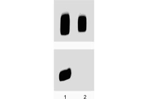 Western Blotting (WB) image for anti-Protein Kinase, CAMP-Dependent, Regulatory, Type II, beta (PRKAR2B) (pSer114) antibody (ABIN968875) (PRKAR2B antibody  (pSer114))