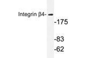 Western blot analysis of Integrin β4 antibody in extracts from HepG2 cells. (Integrin beta 4 antibody)
