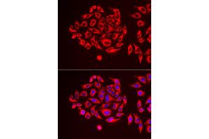 Immunofluorescence analysis of U2OS cells using TUFM antibody (ABIN5973823). (TUFM antibody)