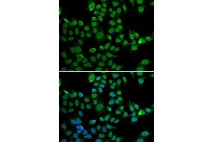 Immunofluorescence (IF) image for anti-Lamin B2 (LMNB2) (AA 341-620) antibody (ABIN6143268)
