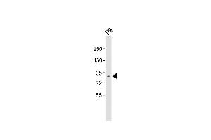 Anti-SUZ12 Antibody (C-term) at 1:2000 dilution + F9 whole cell lysate Lysates/proteins at 20 μg per lane. (SUZ12 antibody  (C-Term))
