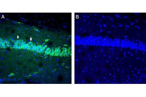 Expression of IGF1 in mouse hippocampus.
