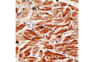 Immunohistochemical analysis of Granzyme A staining in human heart formalin fixed paraffin embedded tissue section. (GZMA antibody)