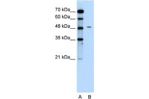 WB Suggested Anti-CHGA Antibody Titration:  0. (Chromogranin A antibody  (C-Term))