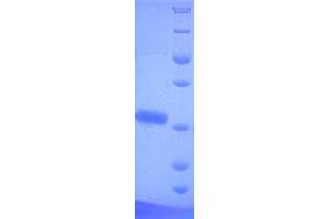 PtxA Gene Product (PTXA) (AA 35-269), (full length) protein (His tag) (PTXA Protein (AA 35-269, full length) (His tag))