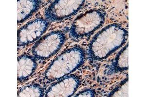 #VALUE! (Transferrin Receptor 2 antibody  (AA 493-784))