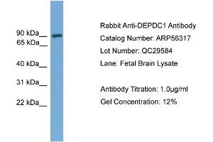 WB Suggested Anti-DEPDC1  Antibody Titration: 0. (DEPDC1 antibody  (Middle Region))