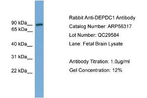 WB Suggested Anti-DEPDC1  Antibody Titration: 0.