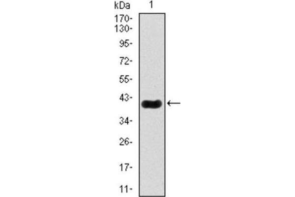 MEF2C antibody  (AA 1-125)