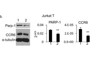 Western Blotting (WB) image for anti-Poly (ADP-Ribose) Polymerase 1 (PARP1) antibody (ABIN2854798)