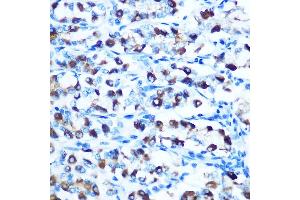 Immunohistochemistry of paraffin-embedded rat stomach using DMT1 Rabbit pAb (ABIN6129471, ABIN6147839, ABIN6147840 and ABIN6214400) at dilution of 1:100 (40x lens). (SLC11A2 antibody  (AA 1-100))