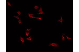 ABIN6266792 staining Hela by IF/ICC. (FKBPL antibody  (Internal Region))
