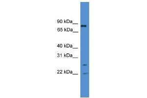 WB Suggested Anti-AKAP8L Antibody Titration:  0. (AKAP8L antibody  (Middle Region))