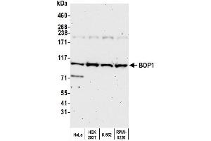 anti-Block of Proliferation 1 (BOP1) (AA 300-350) antibody