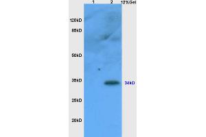 Lane 1: mouse liver lysates Lane 2: mouse thymus lysates probed with Anti CD1A Polyclonal Antibody, Unconjugated (ABIN1386771) at 1:200 in 4 °C. (CD1d1 antibody  (AA 165-270))