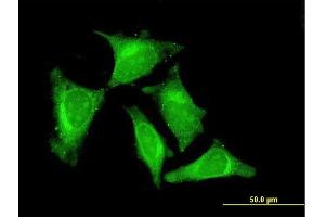 Immunofluorescence of monoclonal antibody to RASGEF1C on HeLa cell.