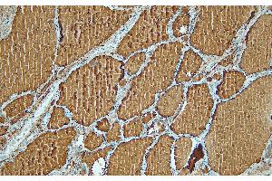 Immunohistochemistry (IHC) image for anti-Thyroglobulin (TG) (C-Term) antibody (ABIN7598886) (Thyroglobulin antibody  (C-Term))