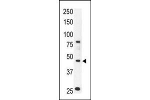 The anti-CCBP2 N-term Pab (ABIN388745 and ABIN2838994) is used in Western blot to detect CCBP2 in mouse liver tissue lysate. (CCBP2 antibody  (AA 54-84))