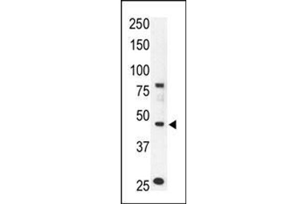 CCBP2 antibody  (AA 54-84)