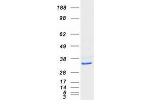 Validation with Western Blot
