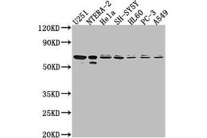 Western Blot Positive WB detected in: U251 whole cell lysate, NTERA-2 whole cell lysate, Hela whole cell lysate, SH-SY5Y whole cell lysate, HL60 whole cell lysate, PC-3 whole cell lysate, A549 whole cell lysate All lanes: CDK17 antibody at 1:2000 Secondary Goat polyclonal to rabbit IgG at 1/50000 dilution Predicted band size: 60 kDa Observed band size: 60 kDa
