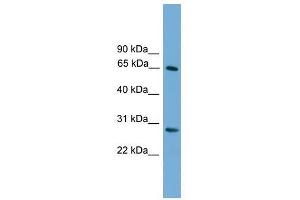 Western Blot showing FBXW8 antibody used at a concentration of 1-2 ug/ml to detect its target protein.
