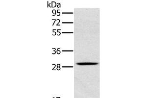 Western Blot analysis of Human testis tissue using CLIC1 Polyclonal Antibody at dilution of 1:400 (CLIC1 antibody)