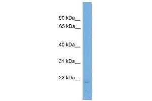 Western Blot showing EDN2 antibody used at a concentration of 1-2 ug/ml to detect its target protein. (Endothelin 2 antibody  (N-Term))