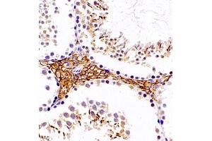 Immunohistochemistry (Paraffin-embedded Sections) (IHC (p)) image for anti-Linker For Activation of T Cells Family, Member 2 (LAT2) antibody (ABIN7074503)