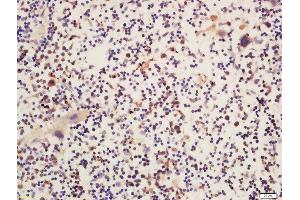 Formalin-fixed and paraffin embedded mouse spleen labeled with Rabbit Anti-Btk (Ser180) Polyclonal Antibody  at 1:200 followed by conjugation to the secondary antibody and DAB staining (BTK antibody  (pSer180))