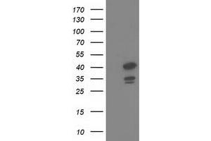 HEK293T cells were transfected with the pCMV6-ENTRY control (Left lane) or pCMV6-ENTRY DNAJB1 (Right lane) cDNA for 48 hrs and lysed. (DNAJB1 antibody)