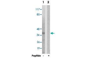 Western blot analysis of extracts from 293 cells, using PTX3 polyclonal antibody . (PTX3 antibody  (N-Term))