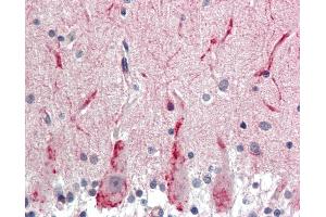 Anti-GABRG2 antibody IHC staining of human brain, cerebellum. (GABRG2 antibody  (AA 61-110))
