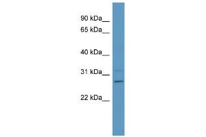 WB Suggested Anti-PSPH Antibody Titration: 0. (PSPH antibody  (Middle Region))