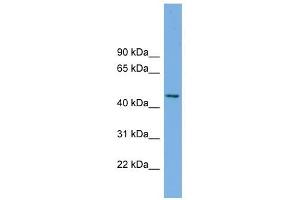 MIPOL1 antibody used at 1 ug/ml to detect target protein. (MIPOL1 antibody  (Middle Region))