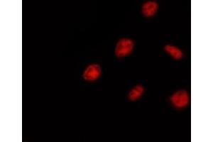 ABIN6275398 staining Hela by IF/ICC. (DDX52 antibody  (C-Term))