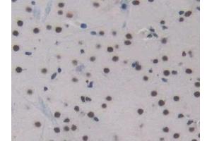 Detection of ENG in Mouse Cerebrum Tissue using Polyclonal Antibody to Endoglin (ENG) (Endoglin antibody  (AA 27-137))