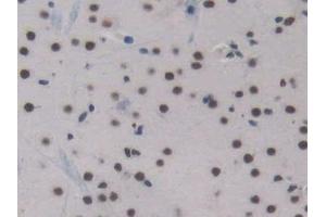 Detection of ENG in Mouse Cerebrum Tissue using Polyclonal Antibody to Endoglin (ENG) (Endoglin antibody  (AA 27-137))