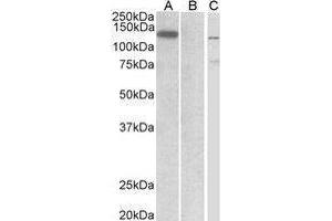 Western Blotting (WB) image for anti-Mindbomb E3 Ubiquitin Protein Ligase 1 (MIB1) (Internal Region) antibody (ABIN2475692) (MIB1 antibody  (Internal Region))