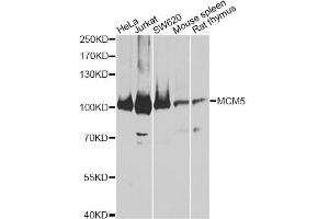 Western blot analysis of extracts of various cell lines, using MCM5 antibody (ABIN5973237) at 1:3000 dilution. (MCM5 antibody)