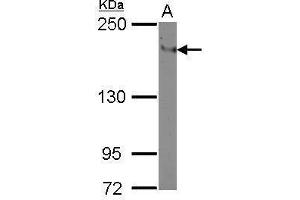 WB Image Sample (30 ug of whole cell lysate) A: THP-1 5% SDS PAGE antibody diluted at 1:500 (ITGAL antibody  (Center))