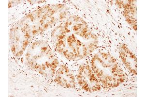 Immunohistochemistry (IHC) image for anti-Forkhead Box K1 (Foxk1) (AA 525-575) antibody (ABIN7454419)