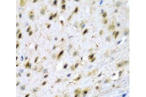 Immunohistochemistry of paraffin-embedded Mouse brain using TPH2 Polyclonal Antibody at dilution of 1:200 (40x lens).