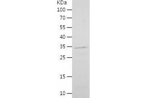 LEF1 Protein (AA 120-399) (His tag)