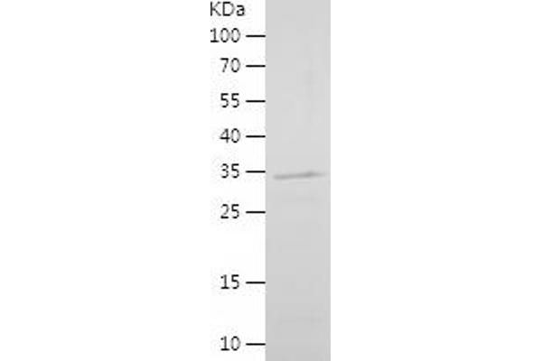 LEF1 Protein (AA 120-399) (His tag)