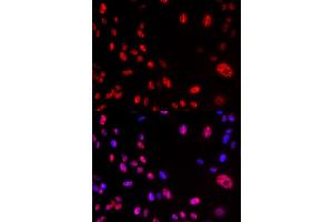 Immunofluorescence analysis of U2OS cells using Phospho-ATM-S1981 antibody (ABIN5969871). (ATM antibody  (pSer1981))