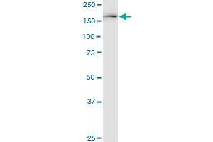 KDM6A monoclonal antibody (M05), clone 4E7. (KDM6A antibody  (AA 641-740))