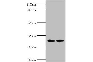 Western blot All lanes: ACBD4 antibody at 2 μg/mL Lane 1: Mouse kidney tissue Lane 2: Mouse liver tissue Secondary Goat polyclonal to rabbit IgG at 1/10000 dilution Predicted band size: 31, 35, 38 kDa Observed band size: 31 kDa (ACBD4 antibody  (AA 1-305))